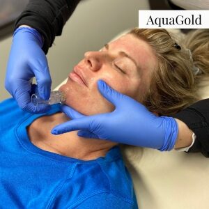 aquagold skin rejuvenation